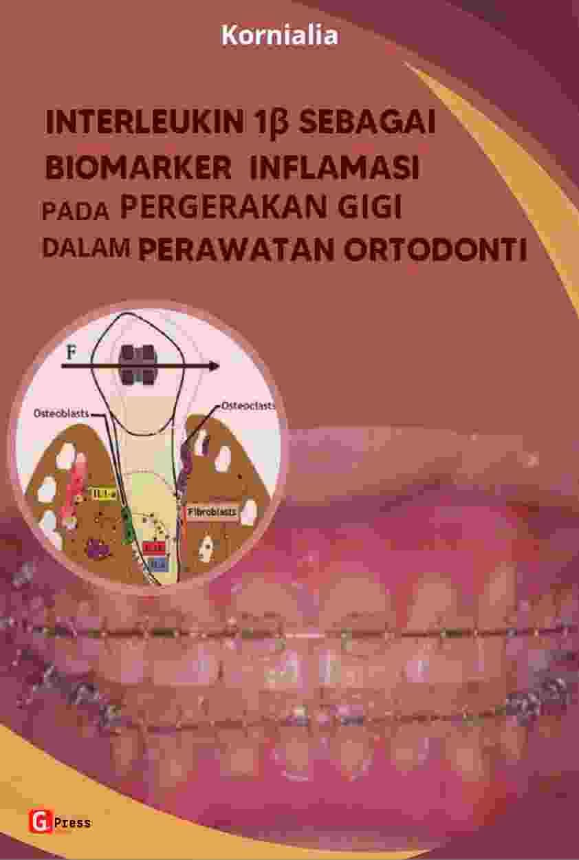 MONOGRAF  INTERLEUKIN SEBAGAI BIOMARKER INFLAMASI PADA PERGERAKAN GIGI DALAM PERAWATAN ORTODONTI